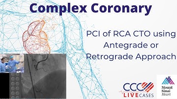 PCI of RCA CTO using Antegrade or Retrograde Approach - July 17, 2018