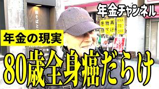 【年金いくら？】80歳無職→「全身癌だらけ…」年金インタビュー！