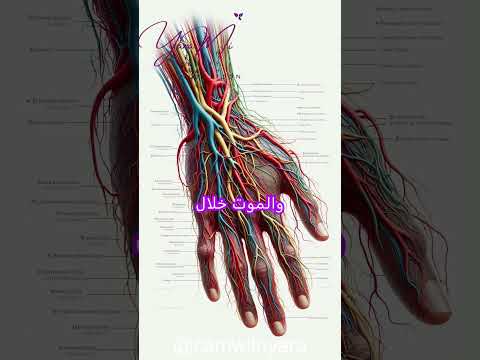 العلاقة بين شريان اليد و القلب و البتر