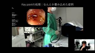 Dr. Karube's Colonoscopy Insertion Technique -Practical Guide- 2nd
