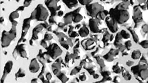 Bone Scaffold-Translated and subtitled by Dang Gia Translation and Consultants Co.