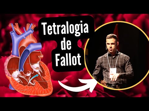 Vídeo: Tem tetralogia de Fallot?