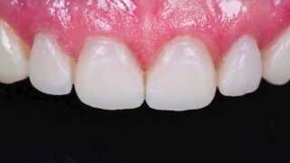 Masterclass June 2013 - McLaren, Chung, and Ercus