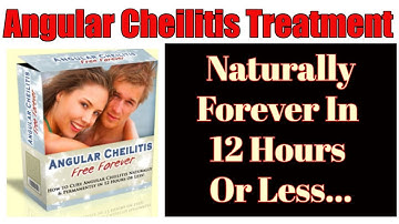 Angular Cheilitis | Angular Cheilitis Treatment | What Causes Angular Cheilitis | Angular Cheilitis