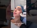 تجميل الوجه بالفيلر كويت دبي ترند  قطر فيلر جدة اكسبلور
