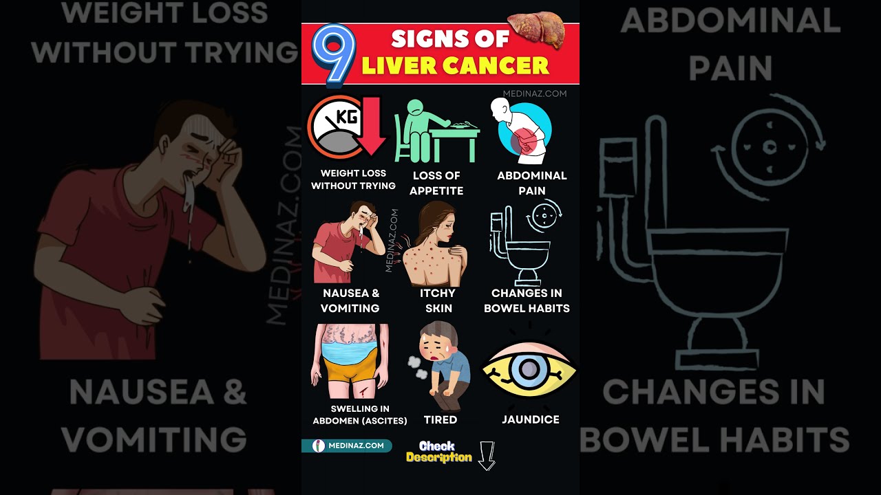 Liver Cancer Warning Signs Don T Ignore These 9 Symptoms 