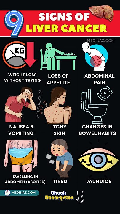 Liver Cancer Warning Signs : Don't Ignore These 9 Symptoms!