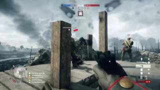 Battlefield™ 1 Grenade Surprise