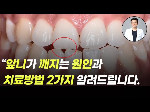 앞니 깨짐, 앞니가 깨지는 원인과 치료방법
