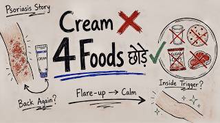 Psoriasis में Creams Fail? मेरी Diet से 80-90% Skin ठीक हुई