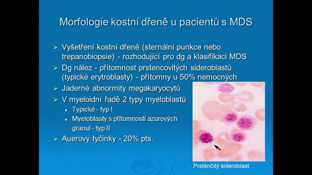 Myelodysplastický syndrom – revidovaná WHO klasifikace a její aplikace  v laboratoři