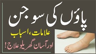 Paon ki sujan / Feet swelling treatment in urdu / Paon ki sujan ka ilaj. screenshot 4