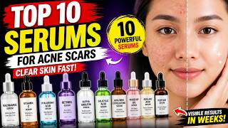 Top 10 Serums for Acne Scars That Actually Work | Clear Skin Fast