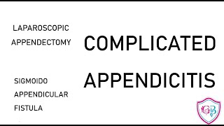 Laparoscopic Appendectomy – Challenging Case of Appendico Sigmoid Fistula