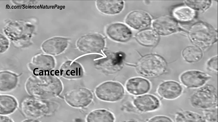 Cancer Research: Exploding Nanobubbles Can Kill Cancer Cells