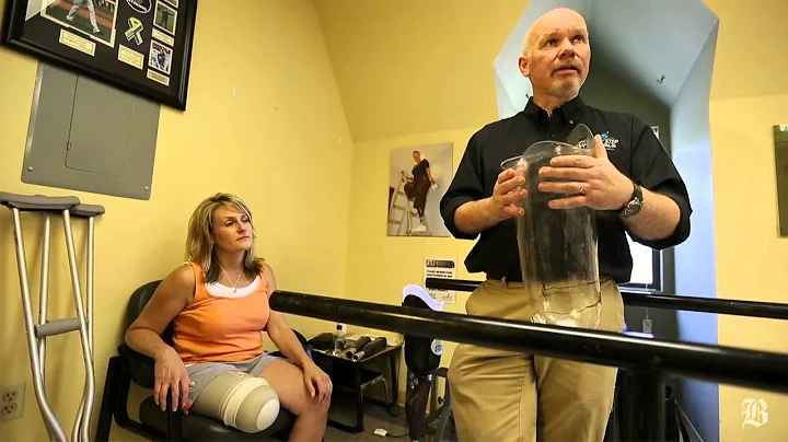 Marathon bombing survivor is fitted for prosthetic limb