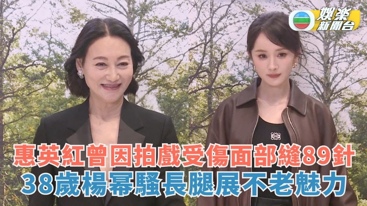 惠英紅拍戲「戰跡」驚人面部曾縫89針 38歲楊幂騷長腿展不老魅力