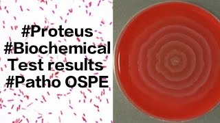 Proteus Tests results (TSI, Motility Indole, Citrate)