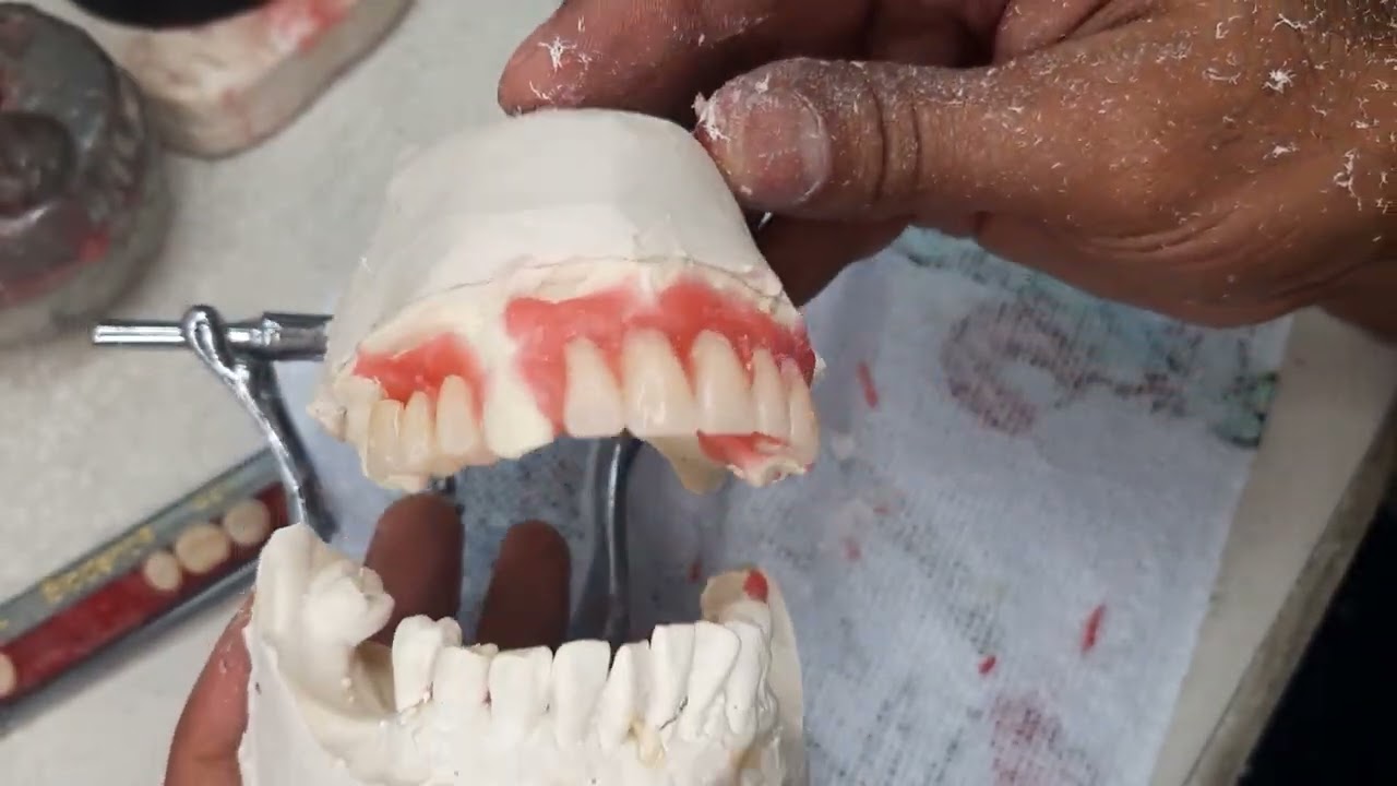 como enfilar una protesis dental | enfilado y festoneado | #dentures