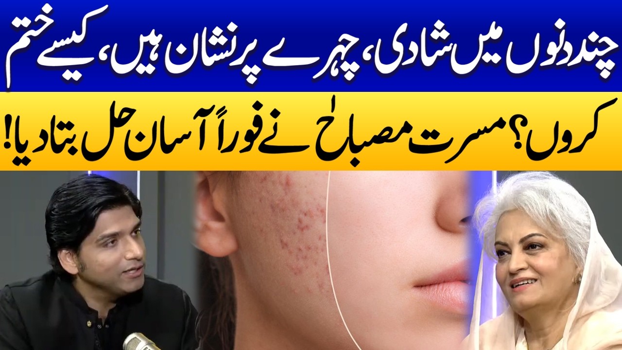 Women’s Major Skin Problem Solved | Musarrat Misbah Shares a Quick Remedy for Facial Marks