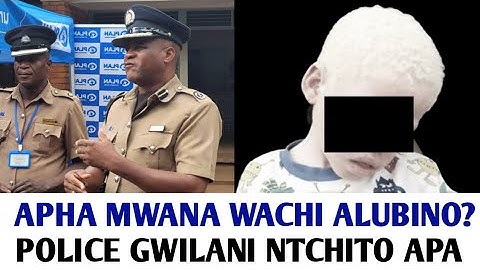 NKHANI YA CHISONI MWANA WAKHUNGU LACHI ALUBINO WASOWA KU MULANJE PANO MA WEEK ATATU ATHA ASAKUPEZEKA