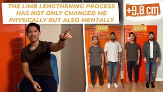 THE LIMB LENGTHENING PROCESS HAS NOT ONLY CHANGED ME PHYSICALLY BUT ALSO MENTALLY