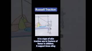russell traction #dailyshorts #government #medical #exam #important #fracture #management #children