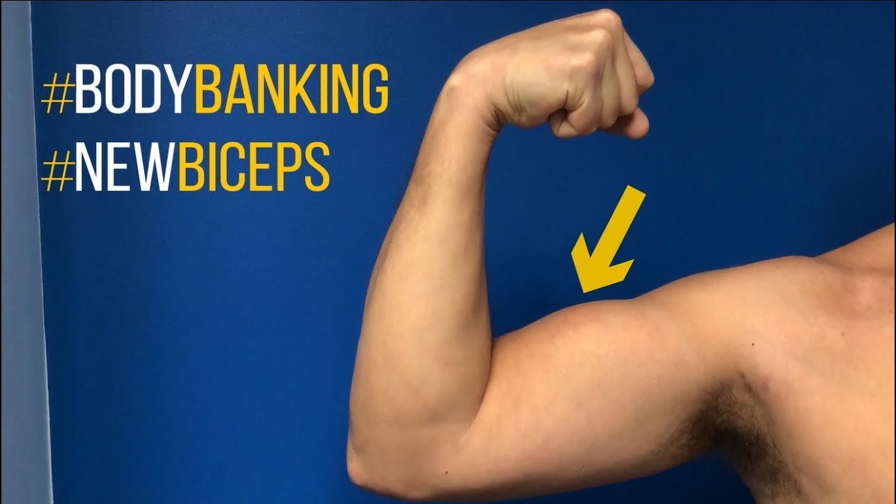 Bicep Augmentation With Body Banking With Dr Steinbrech Nyc And La