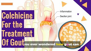 COLCHICINE Tablets For The GOUT Treatment