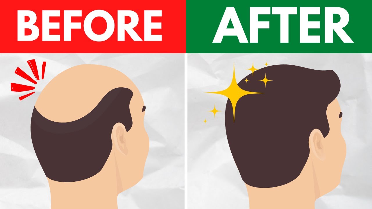 Re-Grow Your Hair FAST: 10 PROVEN All Natural Baldness Hacks | Healthee
