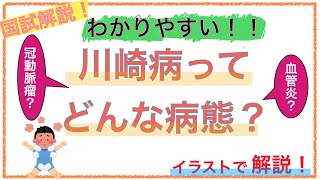 教科書をわかりやすく！「川崎病ってどんな病態？」