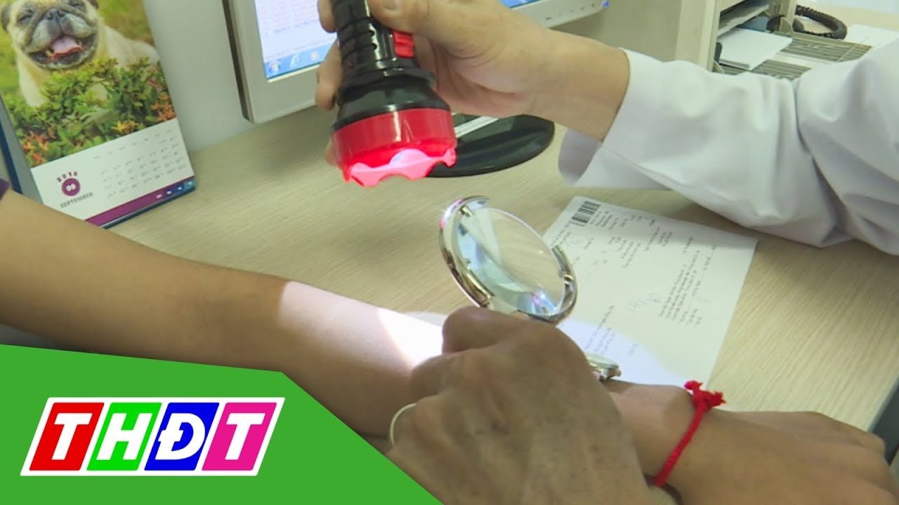 Nổi mề đay, nguyên nhân và cách phòng trị | THDT - youtube