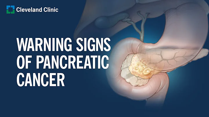 6 Warning Signs of Pancreatic Cancer - DayDayNews