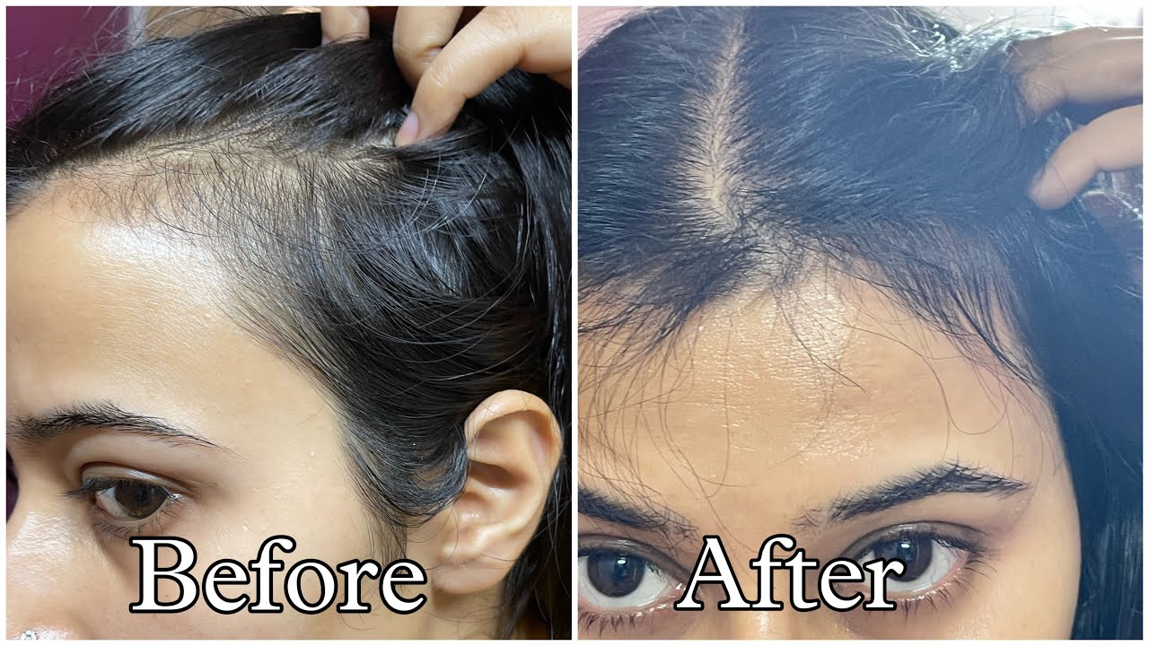 Best Hair Serums For Reduced Hair Fall And Hair Growth YouTube best-hair-serums-for-reduced-hair-fall-and-hair-growth-youtube