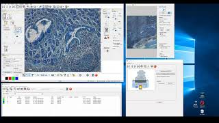 Laser Microdissection from Zeiss