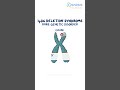 1p36 Deletion Syndrome