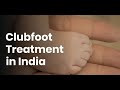 Clubfoot Treatment in India | Clubfoot Treatment Cost in India