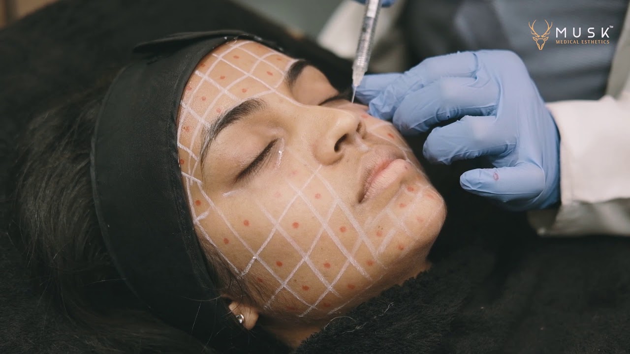 Volite Skin Hydration Therapy | Musk Clinic, India