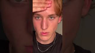 My Eye Area Full Guide