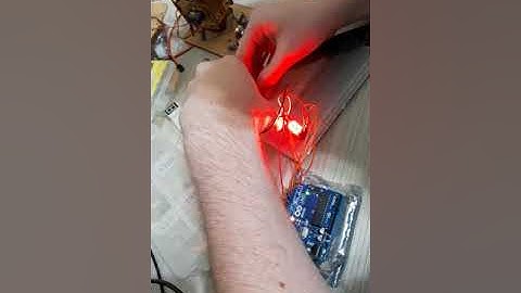 Display 7 segmentos com Arduino Uno