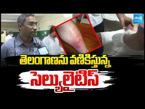 తెలంగాణను వణికిస్తున్నసెల్యులైటిస్ | Cellulitis Tension In Northern Telangana | Sakshi TV - SAKSHITV