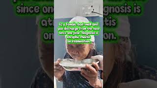 atrophic rhinitis treatment nasal irrigation / nasal syringing #rhinitis #treatment
