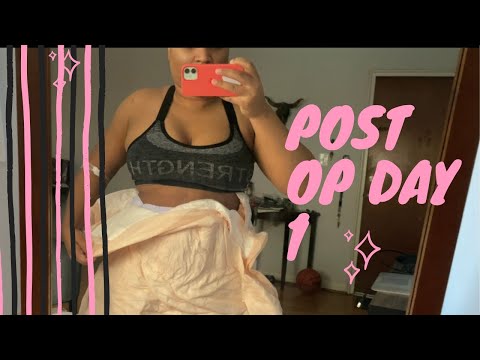 Surgery Day at Sono Bello! | Day 1 Post -Op results !!