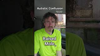 Raised Mole, Autistic Confusion, Walton B. James, ASD & CPTSD #autism #cptsd #shorts #wtf #short