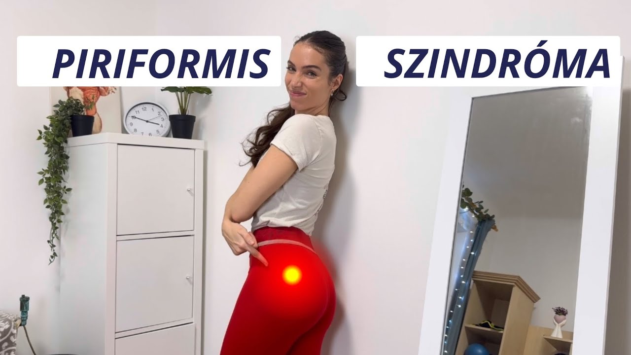 Piriformis szindróma, csípő és ülőideg fájdalom – mit csinálj?