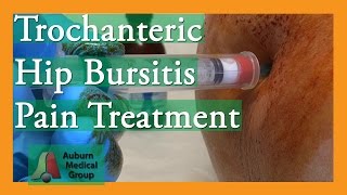 Trochanteric Hip Bursitis Pain Treatment Auburn Medical Group