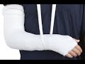 كيف نحافظ على الجبس الطبي