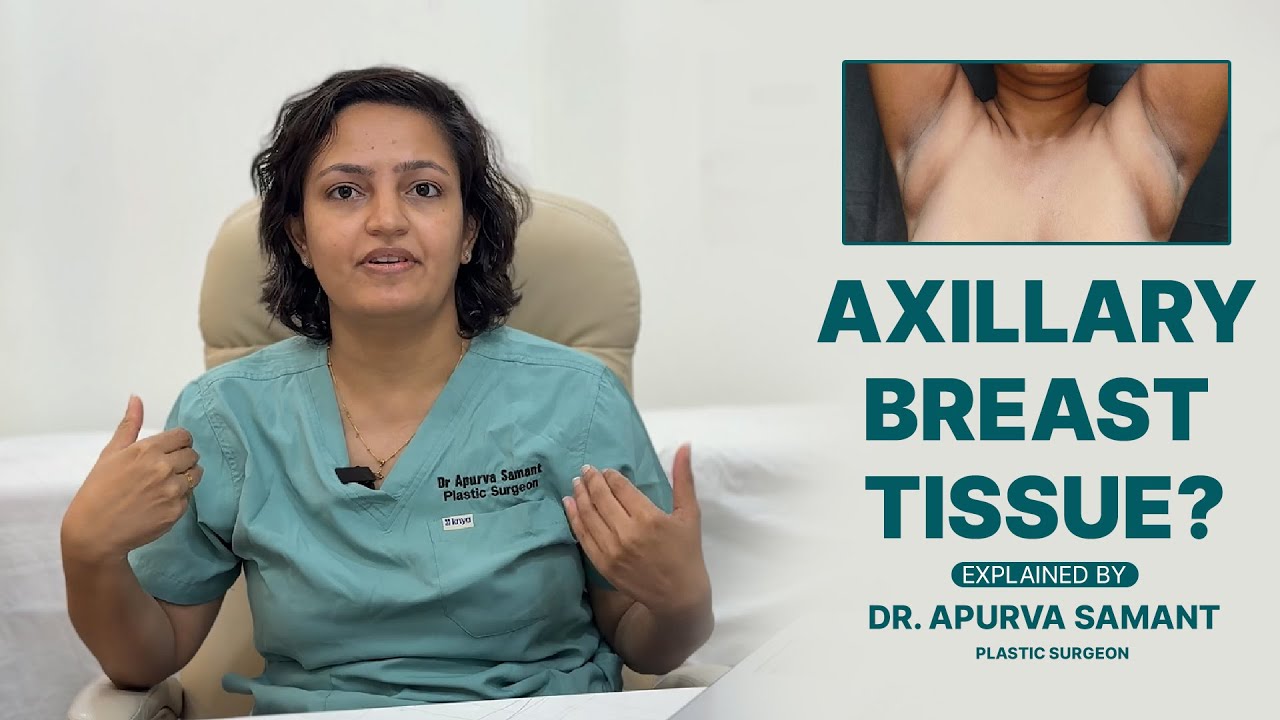 Dr. Apurva Samant | Axillary Breast Tissue | Explainer | Women's ...