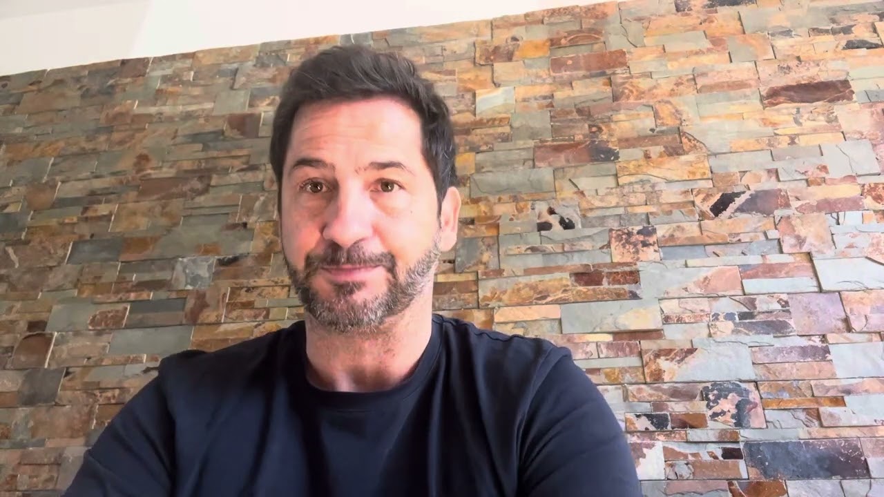 6 mois après ma greffe de cheveux à la clinique COSMEDICA