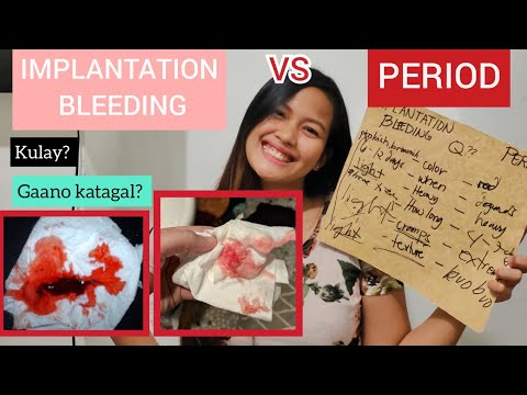 Implantation bleeding vs Period tagalog | Ano ang pagkakaiba ng implantation bleeding sa period
